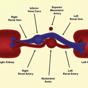 Renal Artery Duplex Scan