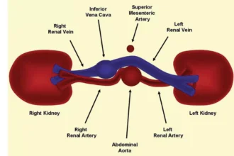 Renal Artery Duplex Scan