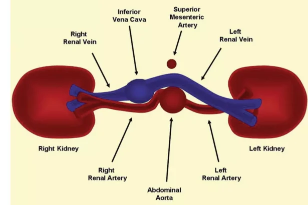 Renal Artery Duplex Scan Home Lady and Care