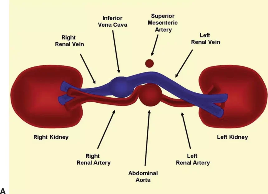 Renal Artery Duplex Scan Home Lady and Care