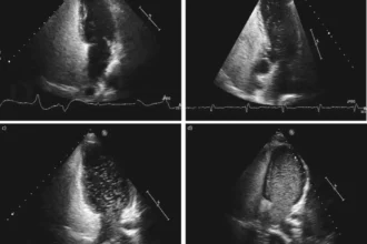 Echo Bubble Study Interpretation