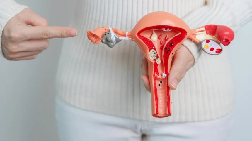 Symptoms Of Granulation Tissue After Hysterectomy Home Lady and Care